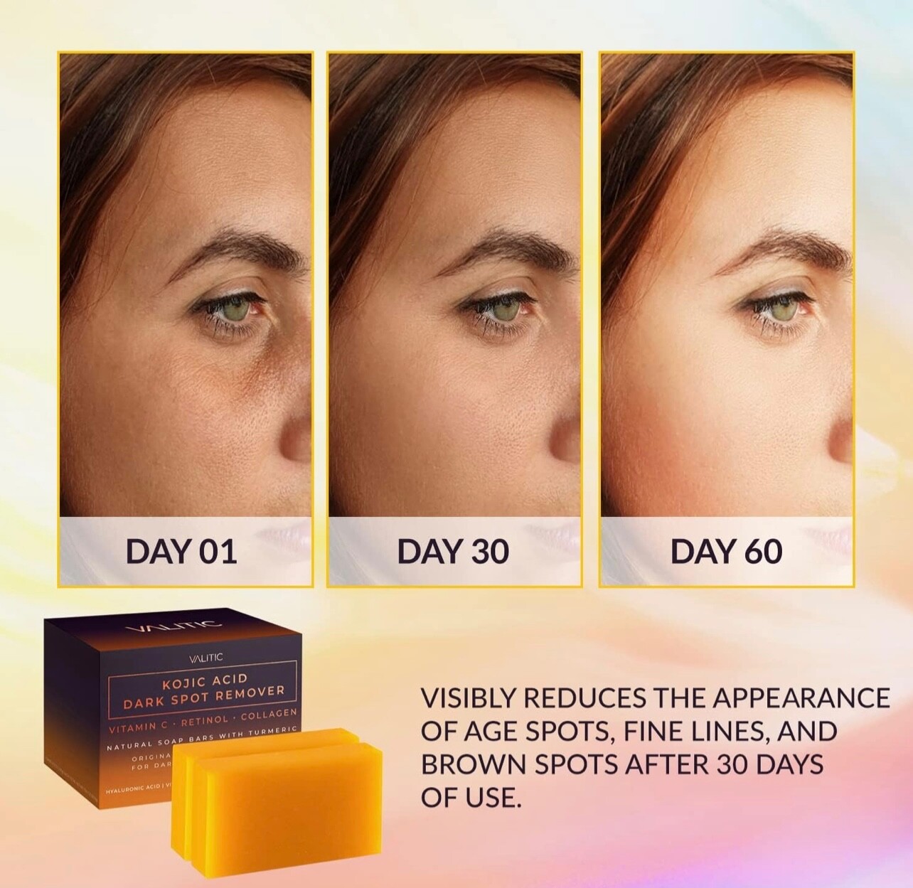 Valitic Kojic Acid Dark Spot Remover Soap Bars – 2 pack
