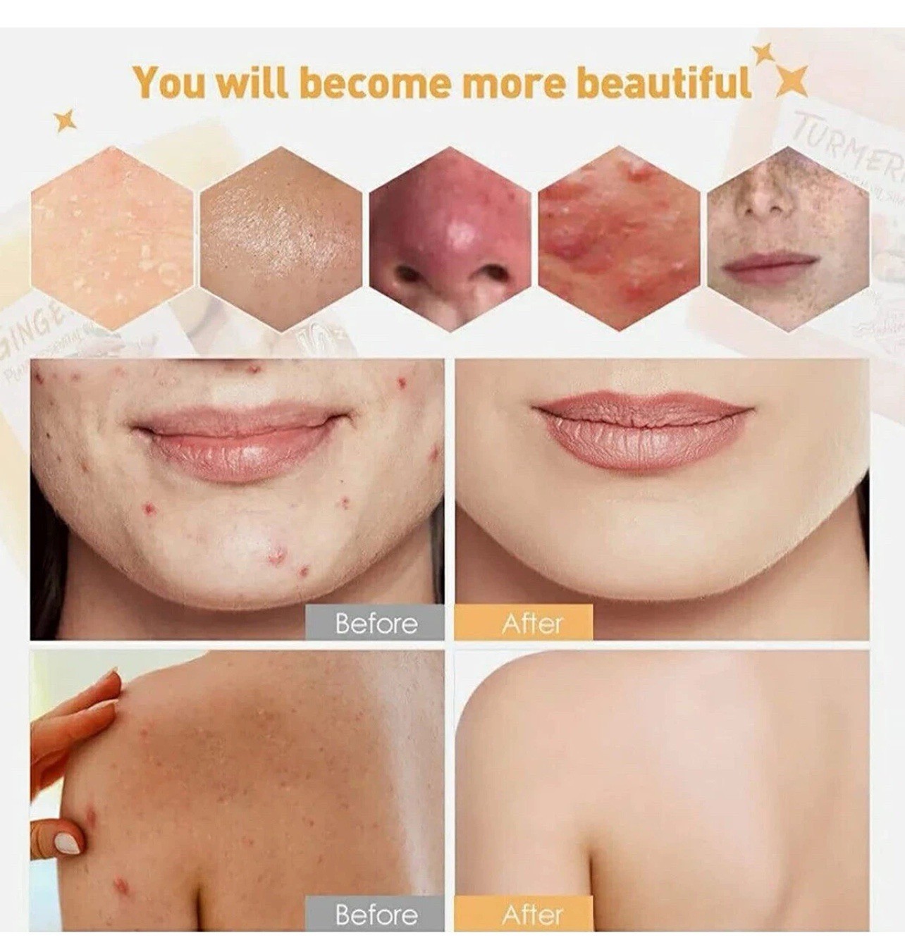 2PCS Tumeric Soap Skin Whitening Dark Spots lightening Acne Brightening Turmeric