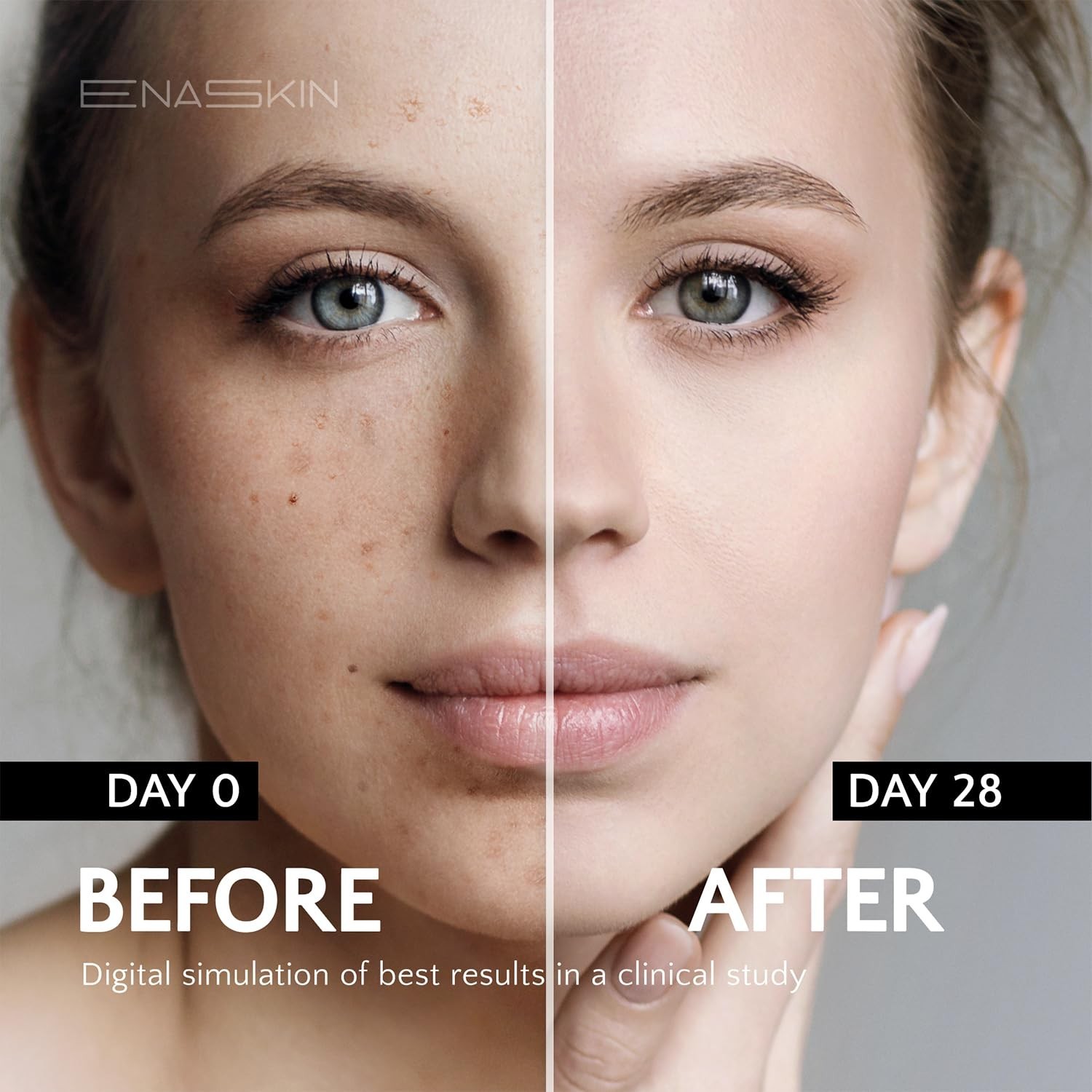 Dark Spot Remover Face & Body Serum Age Spot Sun Spot Freckles Melasma Brown Sp