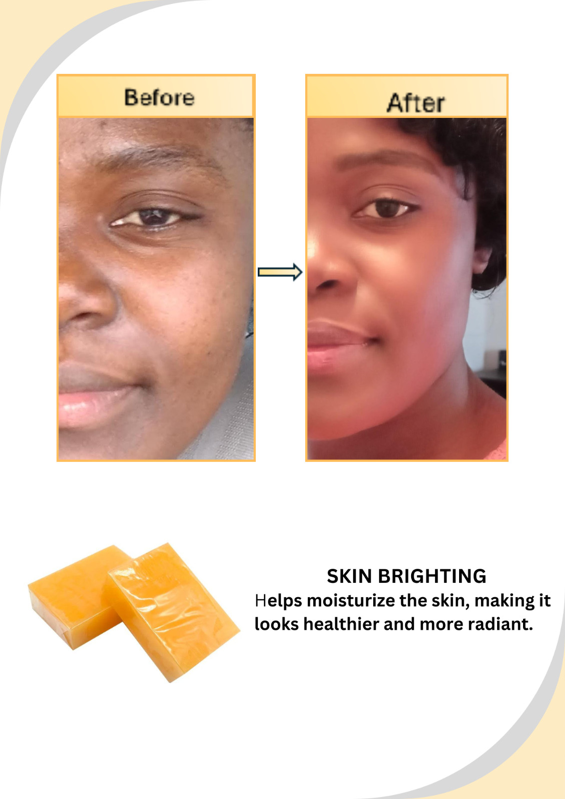 Kojic Acid Soap Dark Spot Whitening Turmeric Skin Bleaching. 200g/7OZ