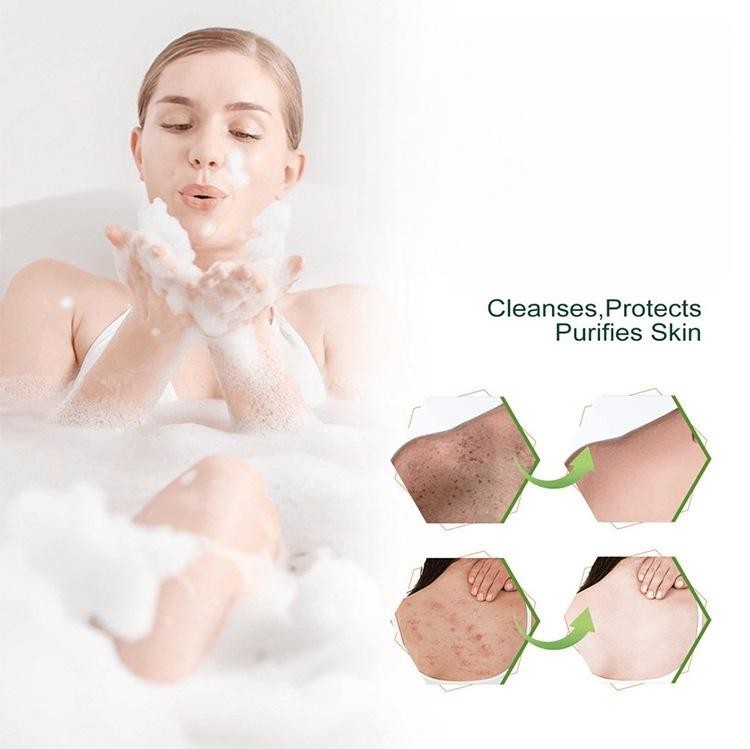 Seoul Secret Soap Lighten SkinTone Fresh MoistureArbutin Dry Skin Moisturi HOT