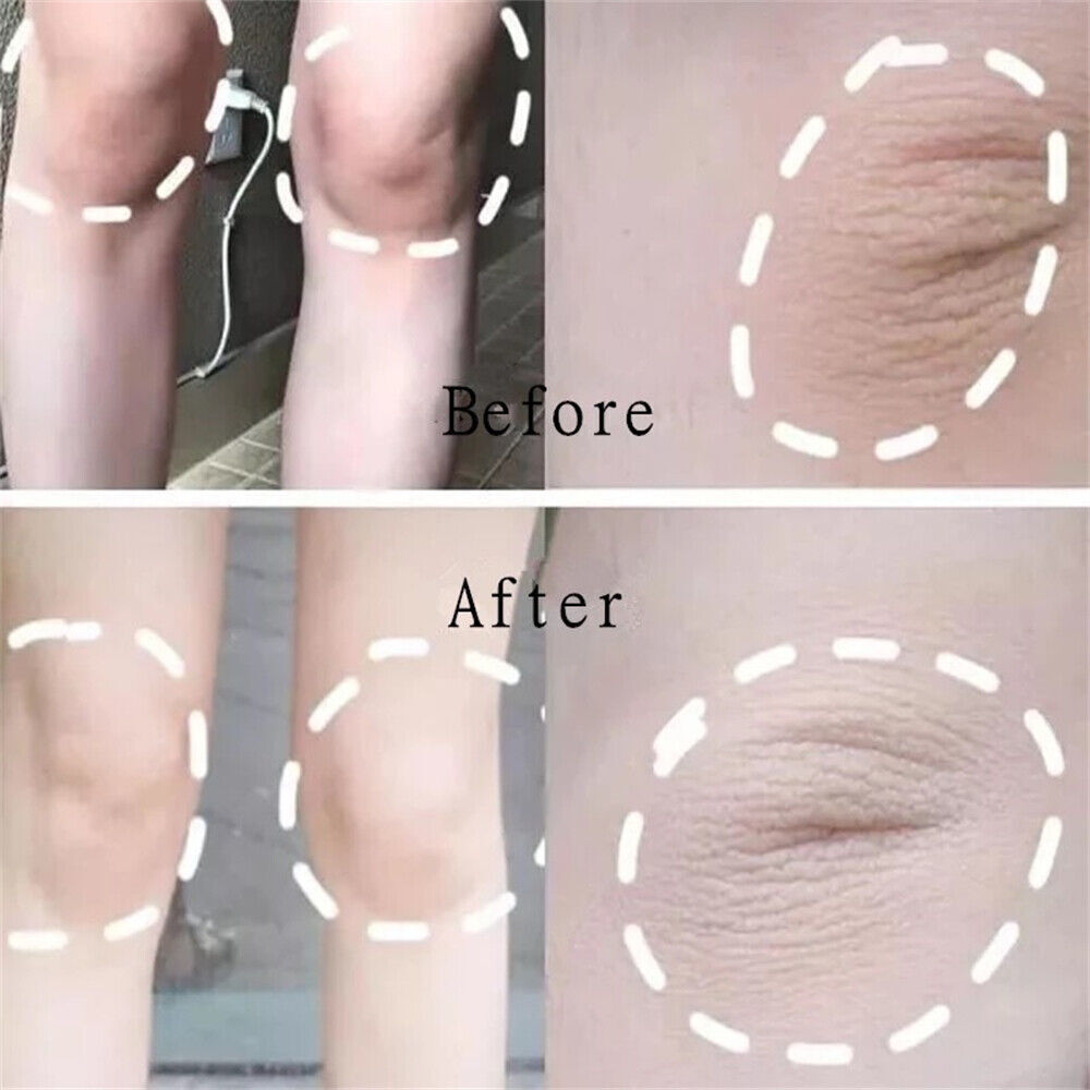 Kojic Acid Skin Whitening Soap Acne Lightening Bar 100g Facial Body Care Soap