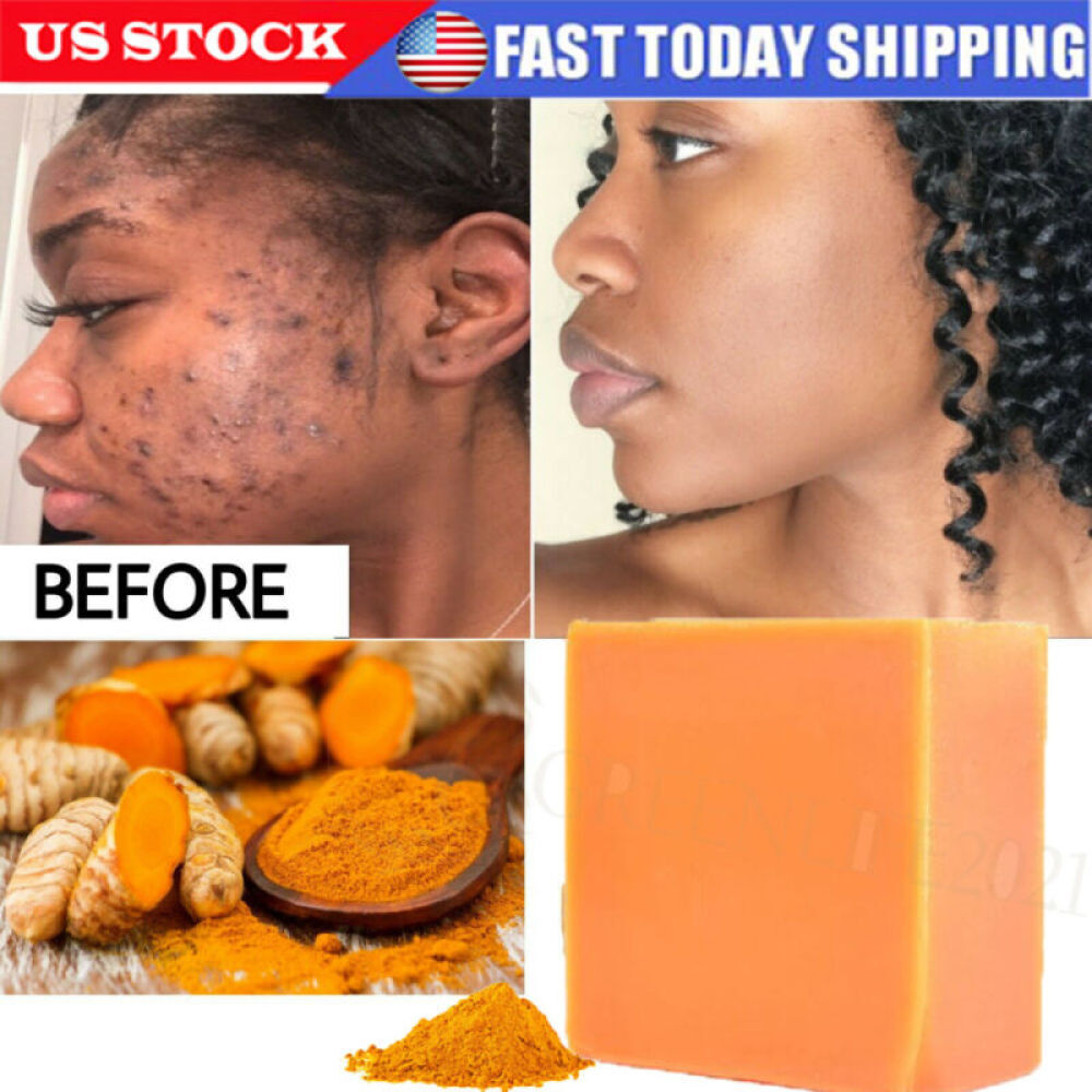8Pcs Turmeric Soap Anti Acne Skin Whitening Face & Body Dark Spots Removal 100g