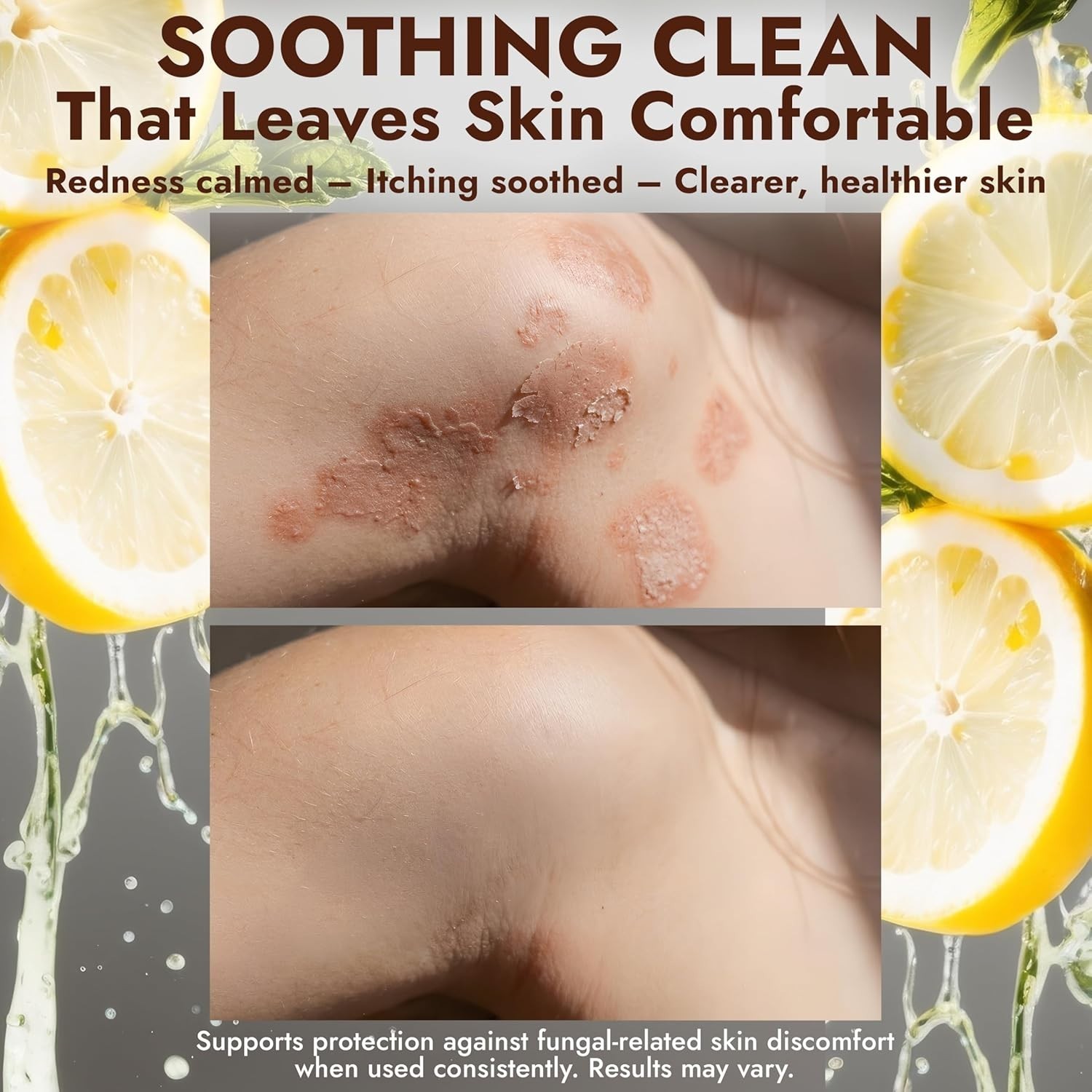 Antifungal Soap with Lemon Oil | Medicated Jock Itch Treatment | Tolnaftate 1%