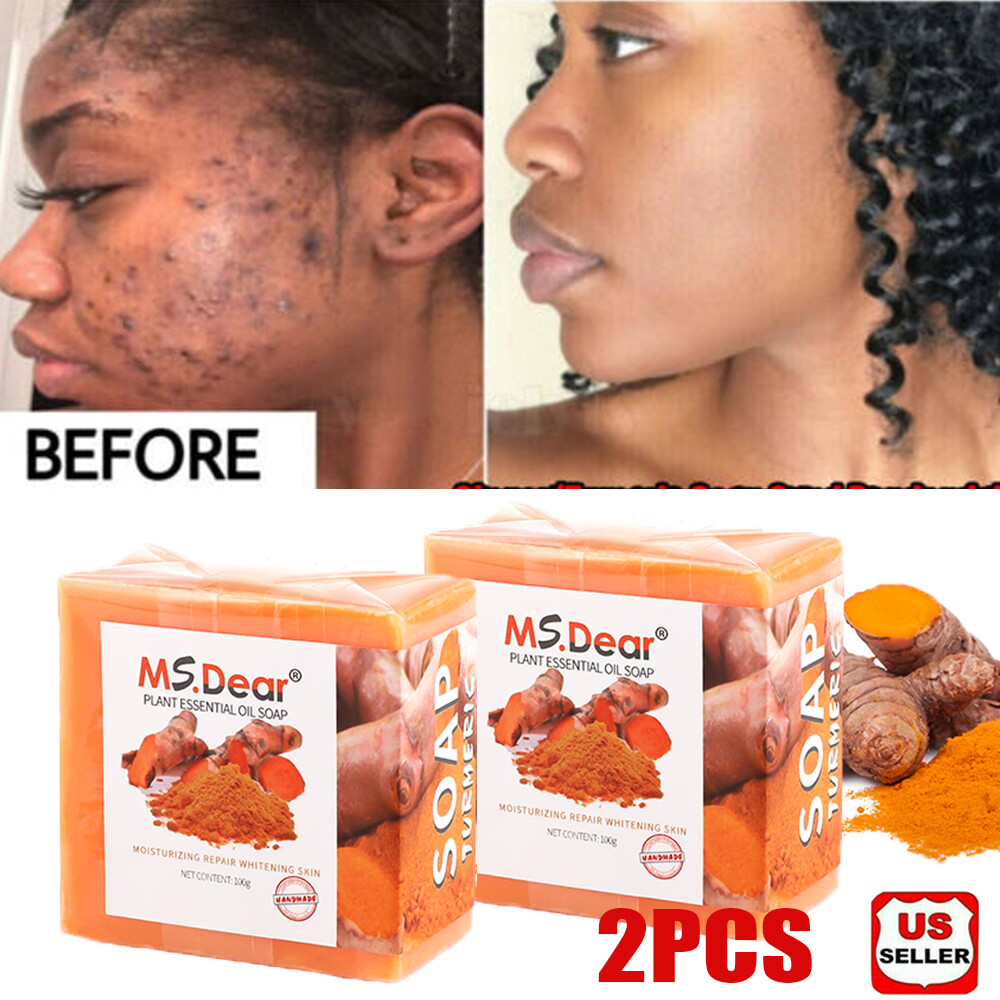 2X 100g Tumeric Soap Skin Whitening Dark Spots lightening Acne Brightening Soap
