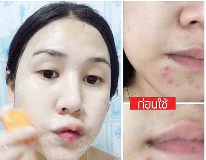 Asantee Soap Papaya Honey Skin Herbal Face Body Q10 AHA BHA 125 g Whitening