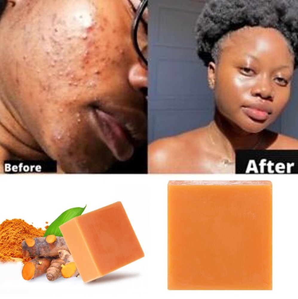 2× Tumeric Soap Skin Whitening Dark Spots lightening Acne Brightening Turmeric
