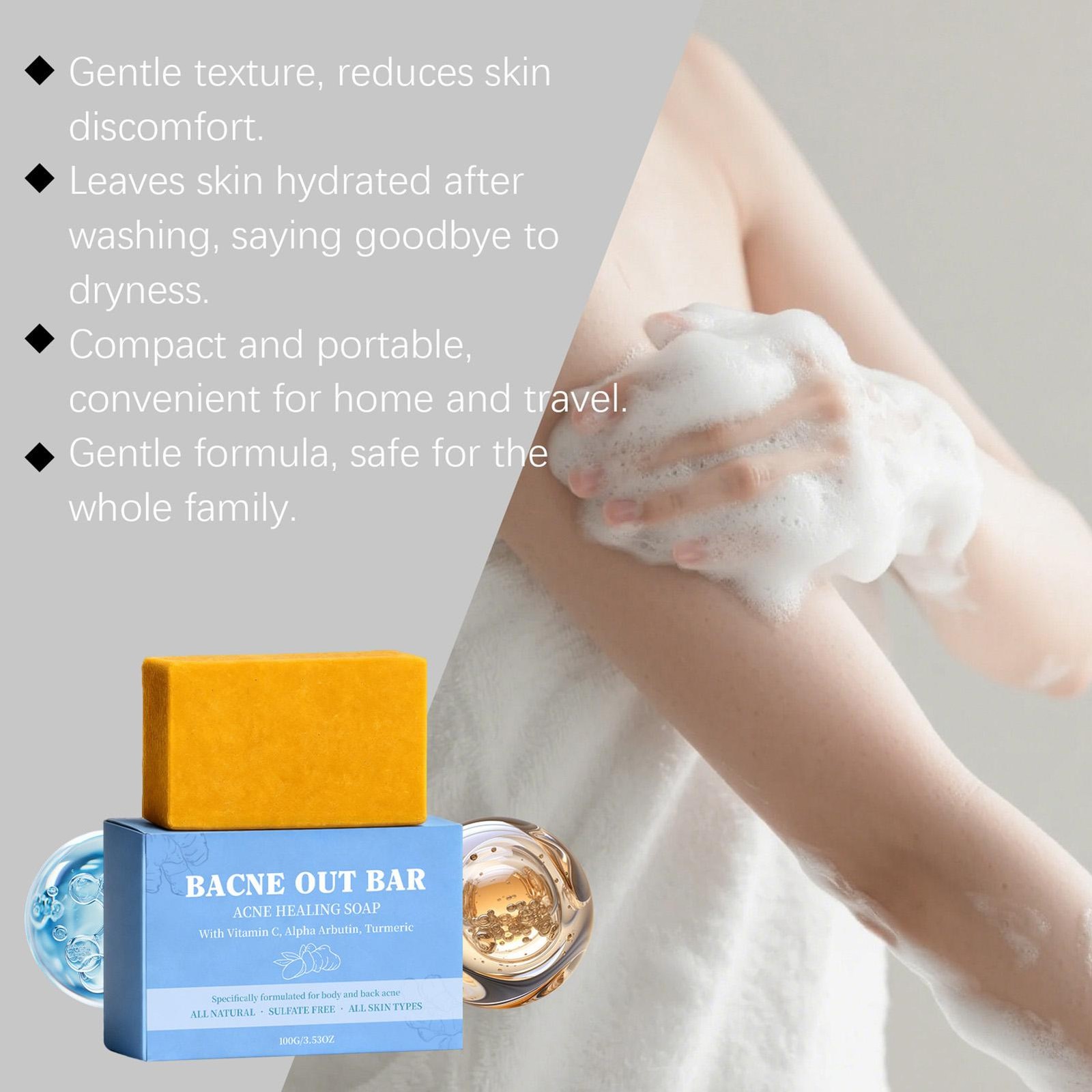 Bacne Out Bar, Acne Healing Soap with Turmeric Vitamin C& Alphaarbutin