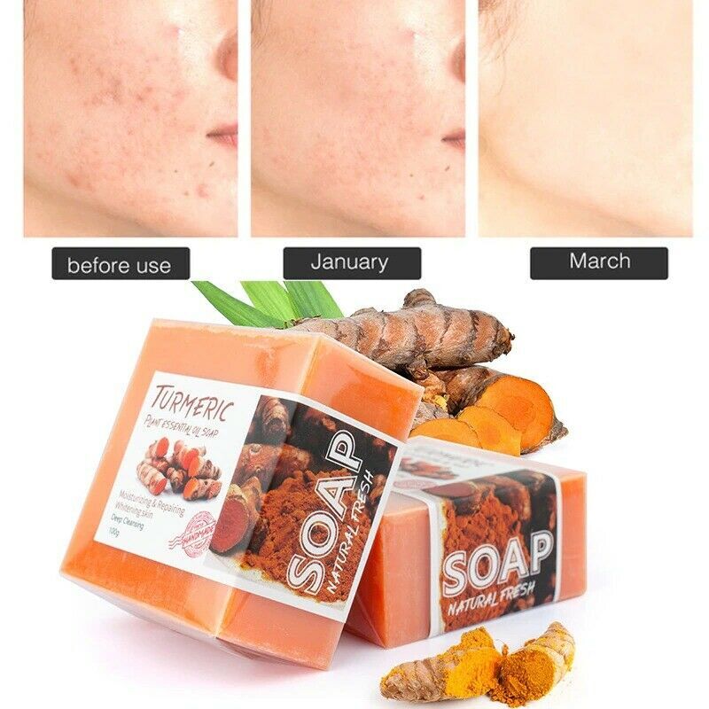 3× Turmeric Soap Natural Herbal Whitening Handmade Soap For Acne And Dark Spots