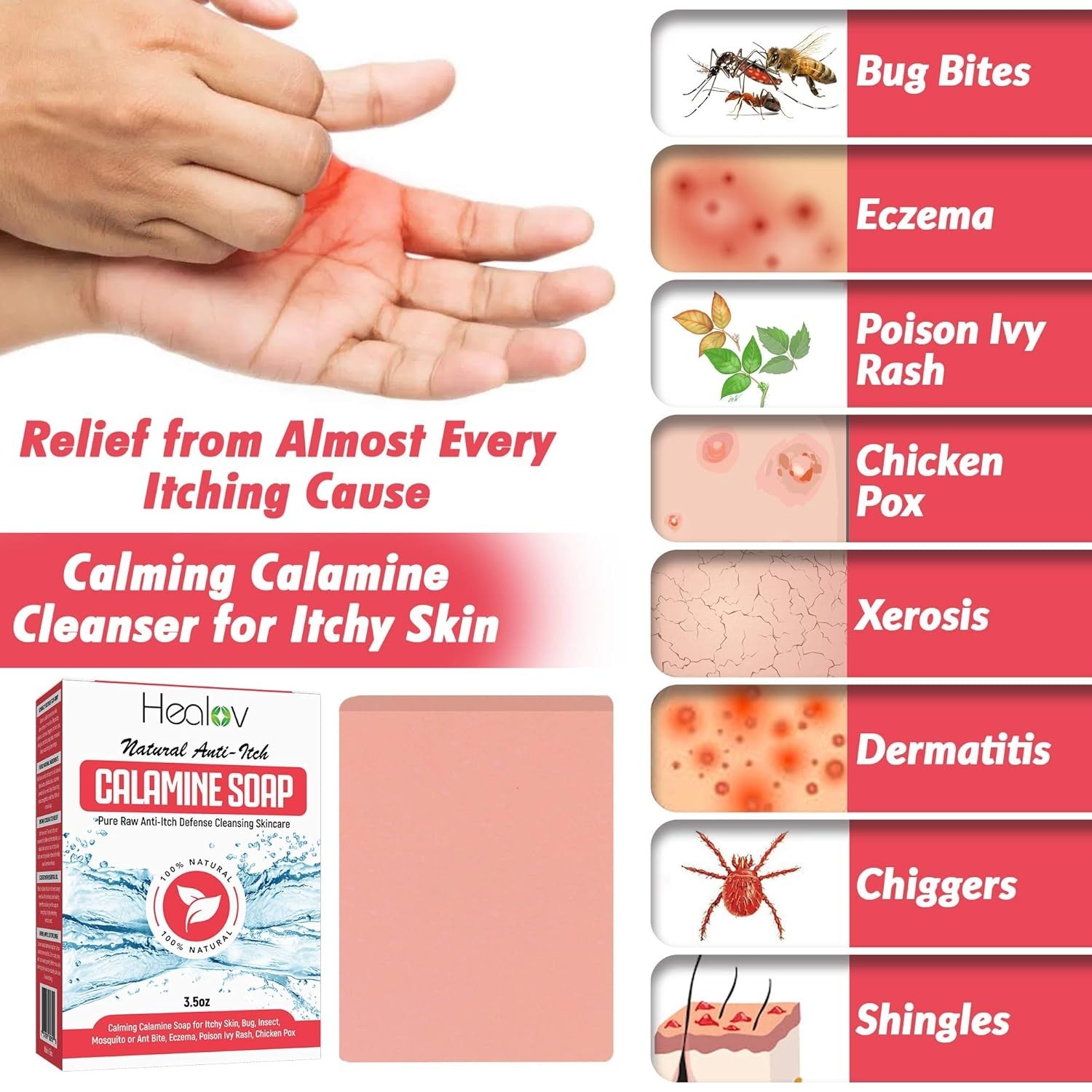 Calamine Soap Bar – Natural Itch Relief for Eczema & Insect Bites, 4oz