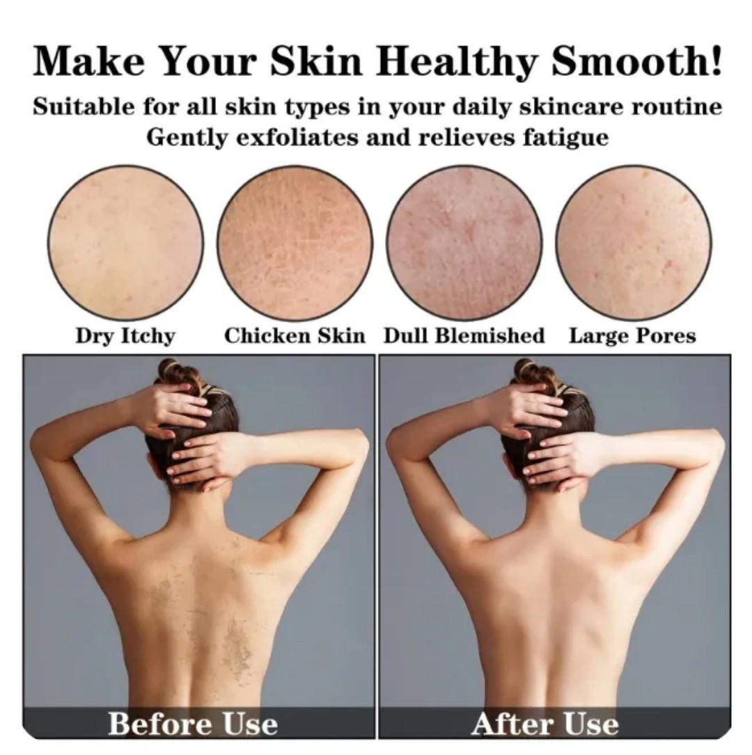 2pcs Ginger Soap Bar, Darkspots Face and Body Soap, 100g [USA Stock]