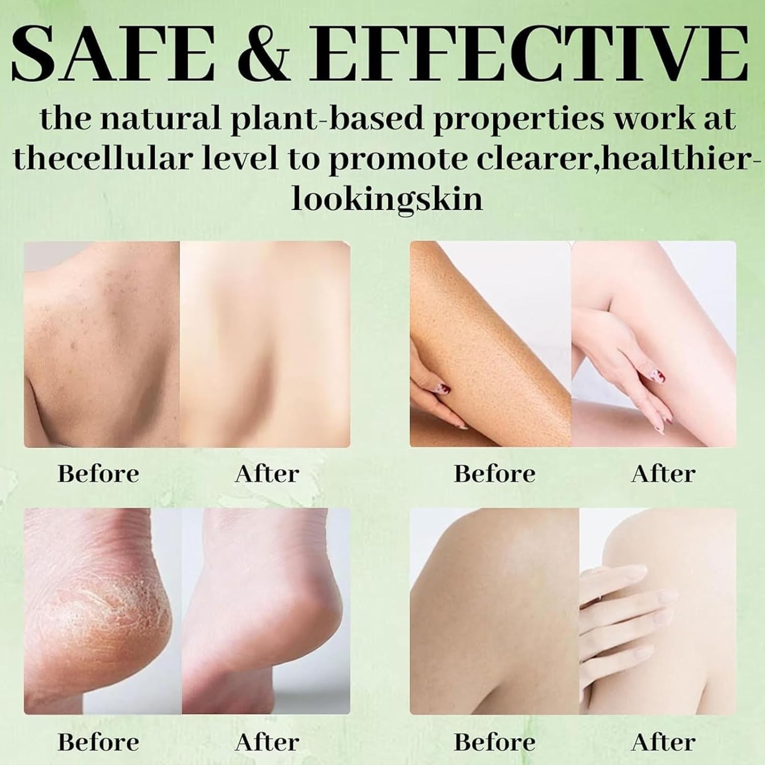 Antifungal Medicated Soap Bar, Athletes Foot Jock Itch Ringworm Yeast Infection