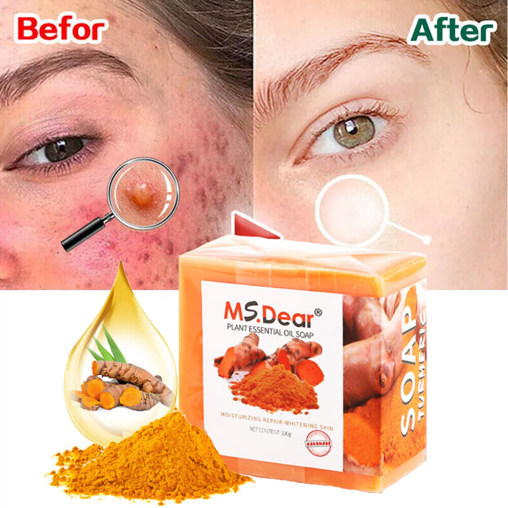 3PCS Tumeric Soap For Dark Spots, Skin Lightening, Anti Acne Skin Cleansing Soap
