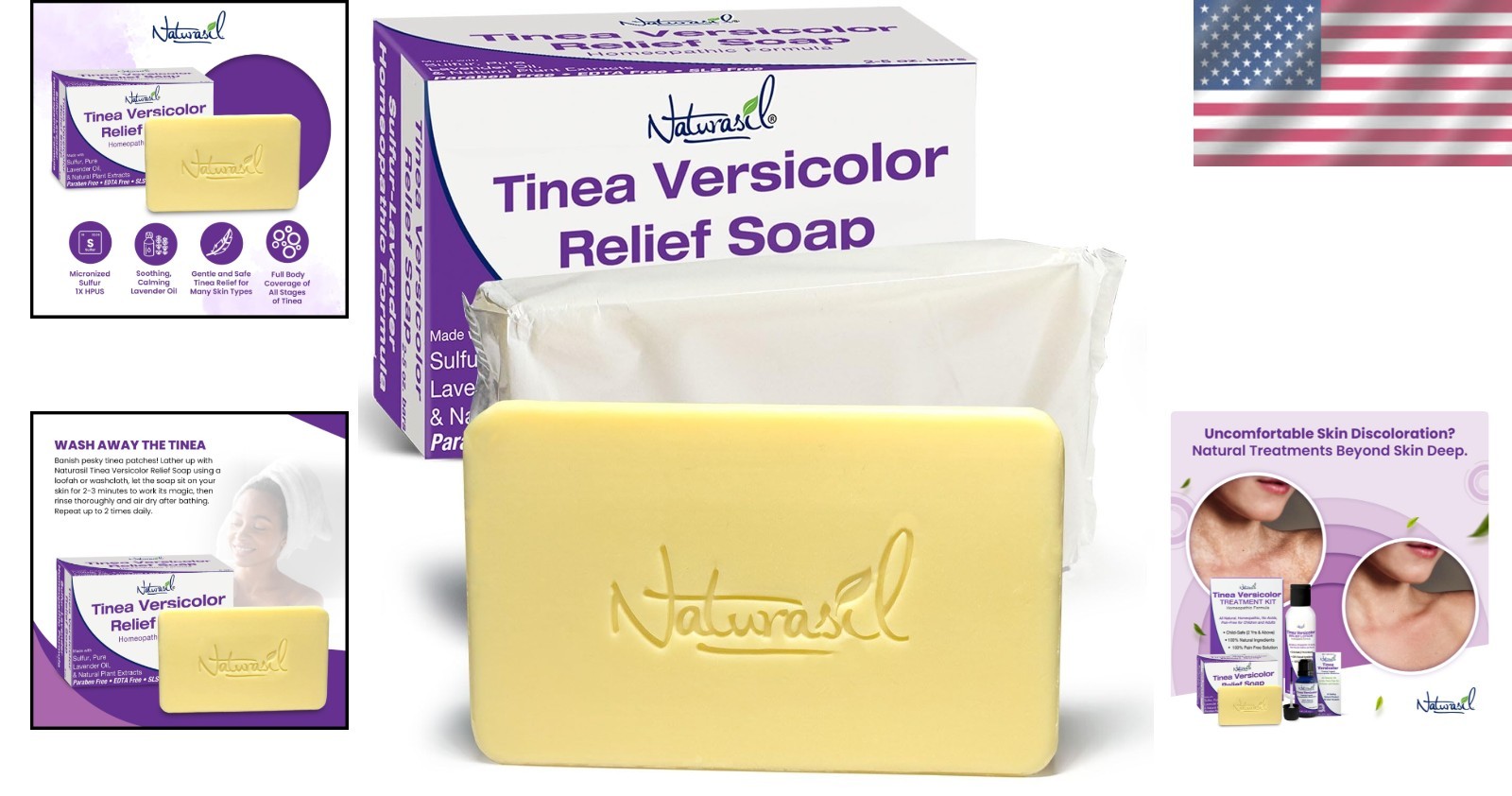 Natural Tinea Versicolor Soap 2-Pack | Lavender Scent, Skin Soothing Formula