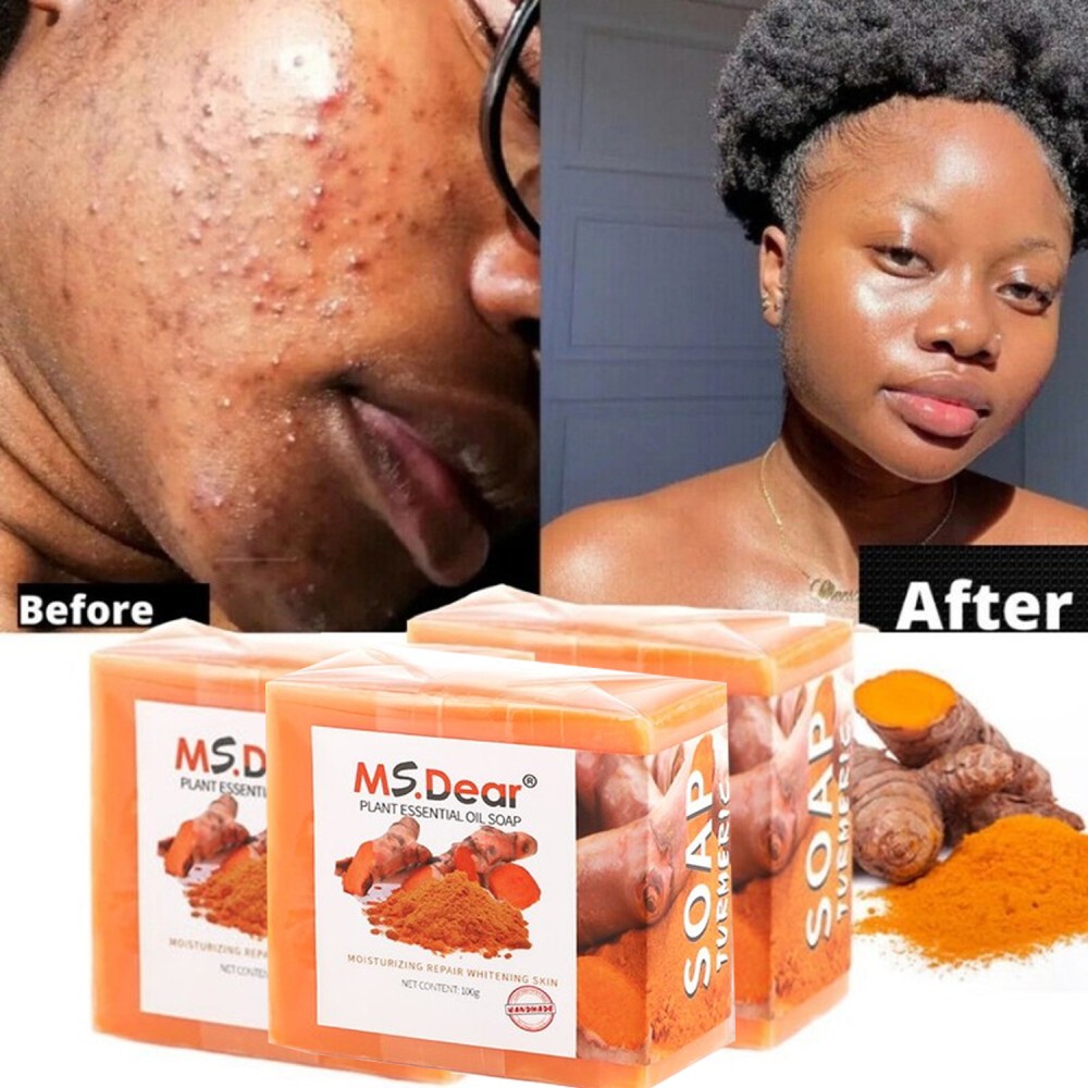 3X100g Turmeric Soap Skin Whitening Soap Dark Spots lightening Acne Brightening
