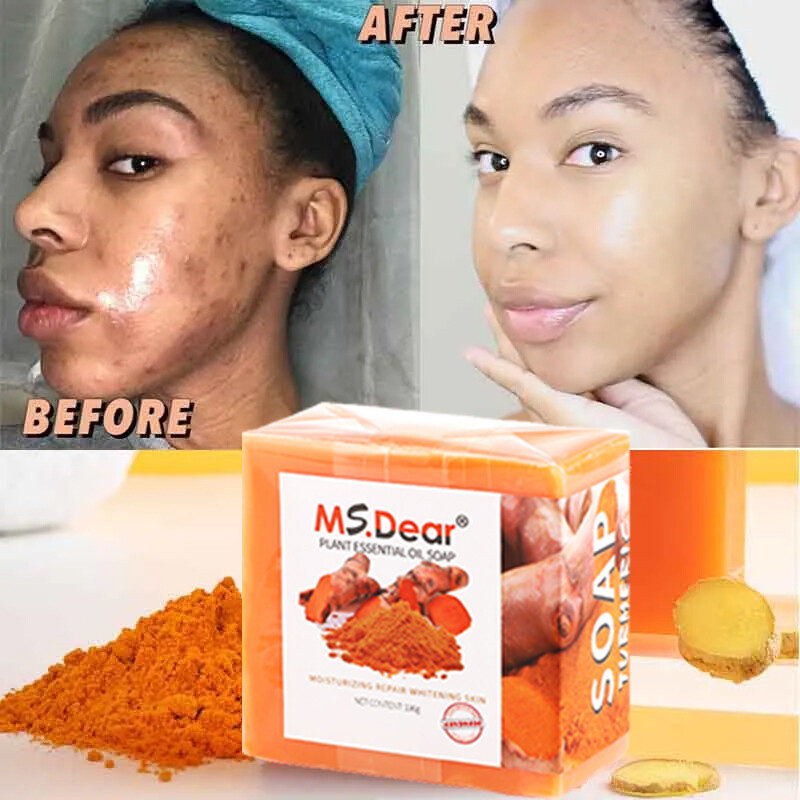 2PCS Tumeric Soap For Dark Spots, Skin Lightening, Anti Acne Cleansing Soap Bar