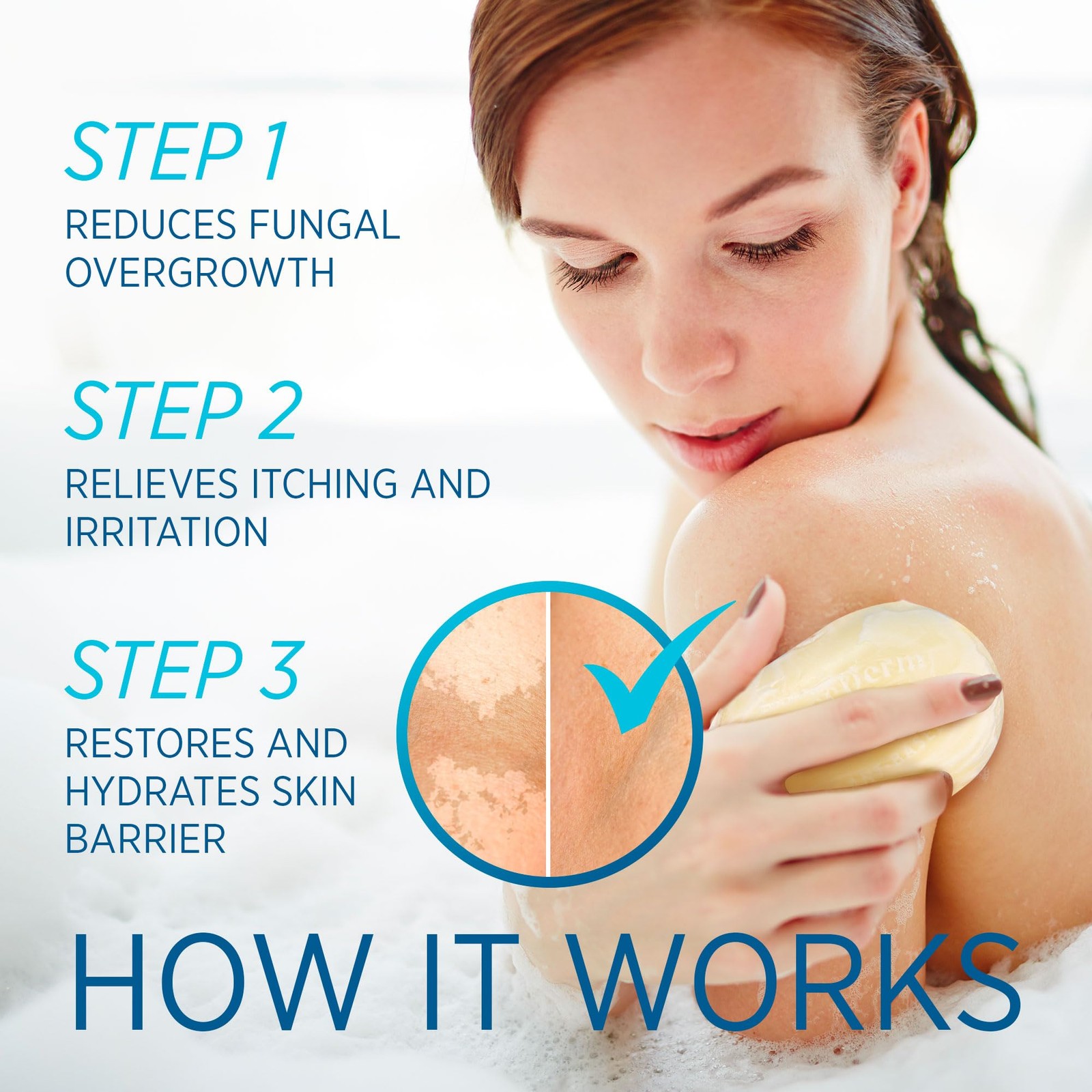 Tinea Versicolor Relief Soap Tea Tree Oil & Sulfur Cleansing Bar, Soothes Irr…