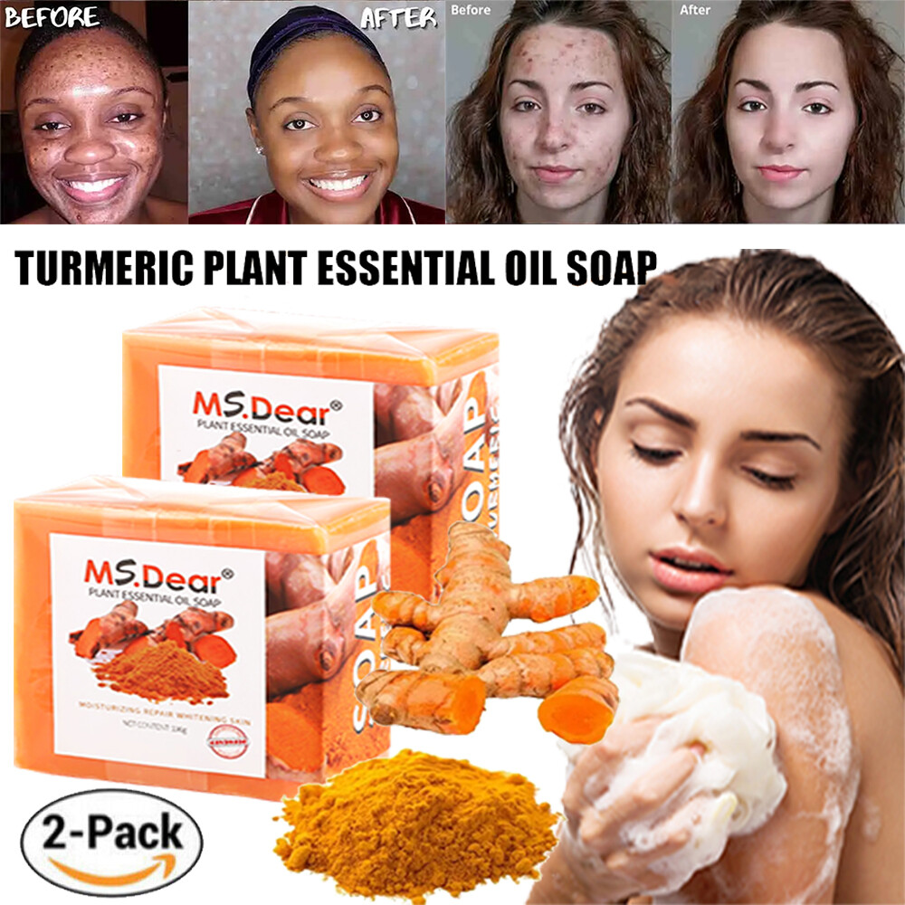 2PCS Tumeric Soap For Dark Spots, Skin Lightening, Anti Acne Cleansing Soap Bar