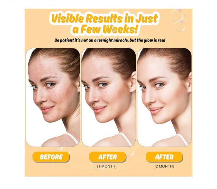 3PACK Kojic Acid Soap for Dark Spots Whitening Turmeric Soap Skin Lightening