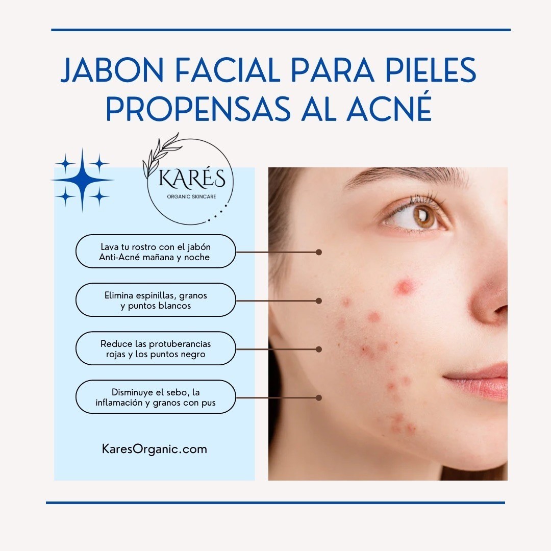 JABON FACIAL ANTI-ACNE ELIMINA GRASA, ESPINILLAS,GRANOS, PUS Y ENROJECIMIENTO!