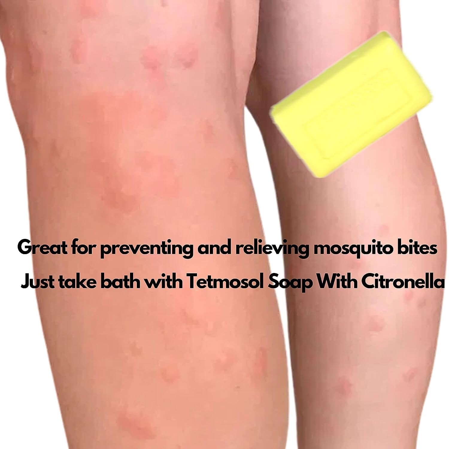 8 X Tetmosol Medicated Soap Citronella LOT OF 8 SOAPS. USA SELLER