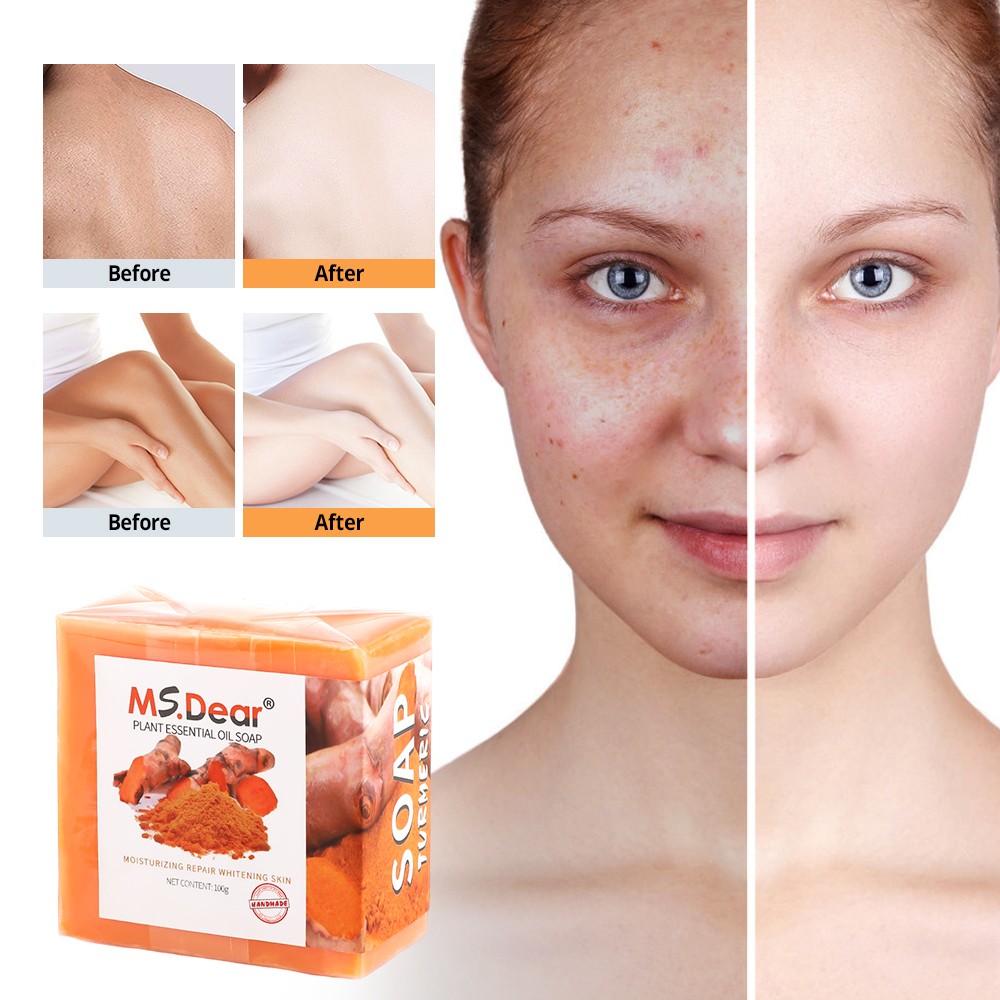 Natural Ginger Soap Turmeric Soap Facial Body Clean Skin Brightening Soap 100g