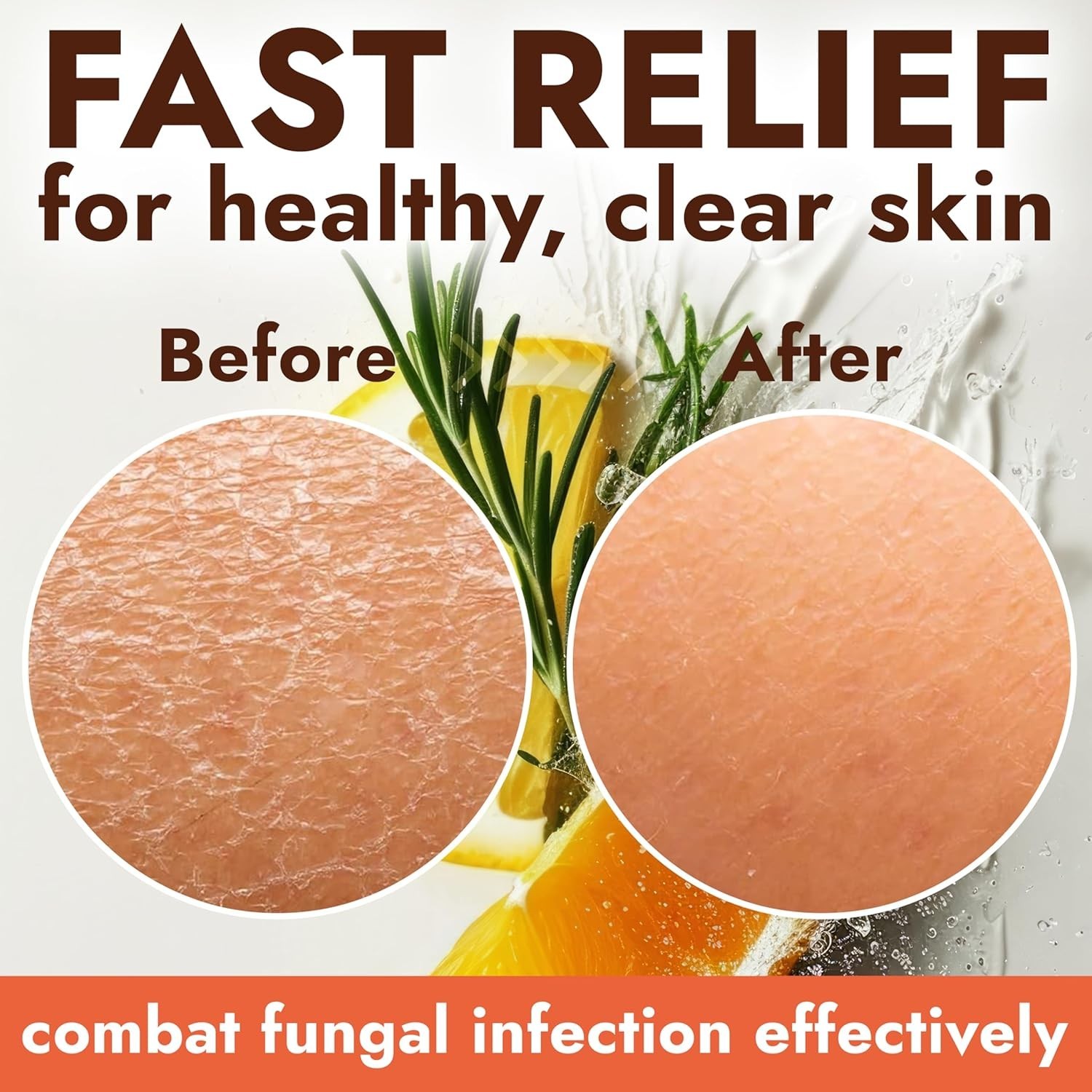Antifungal Soap with Lemon Oil | Medicated Jock Itch Treatment | Tolnaftate 1%
