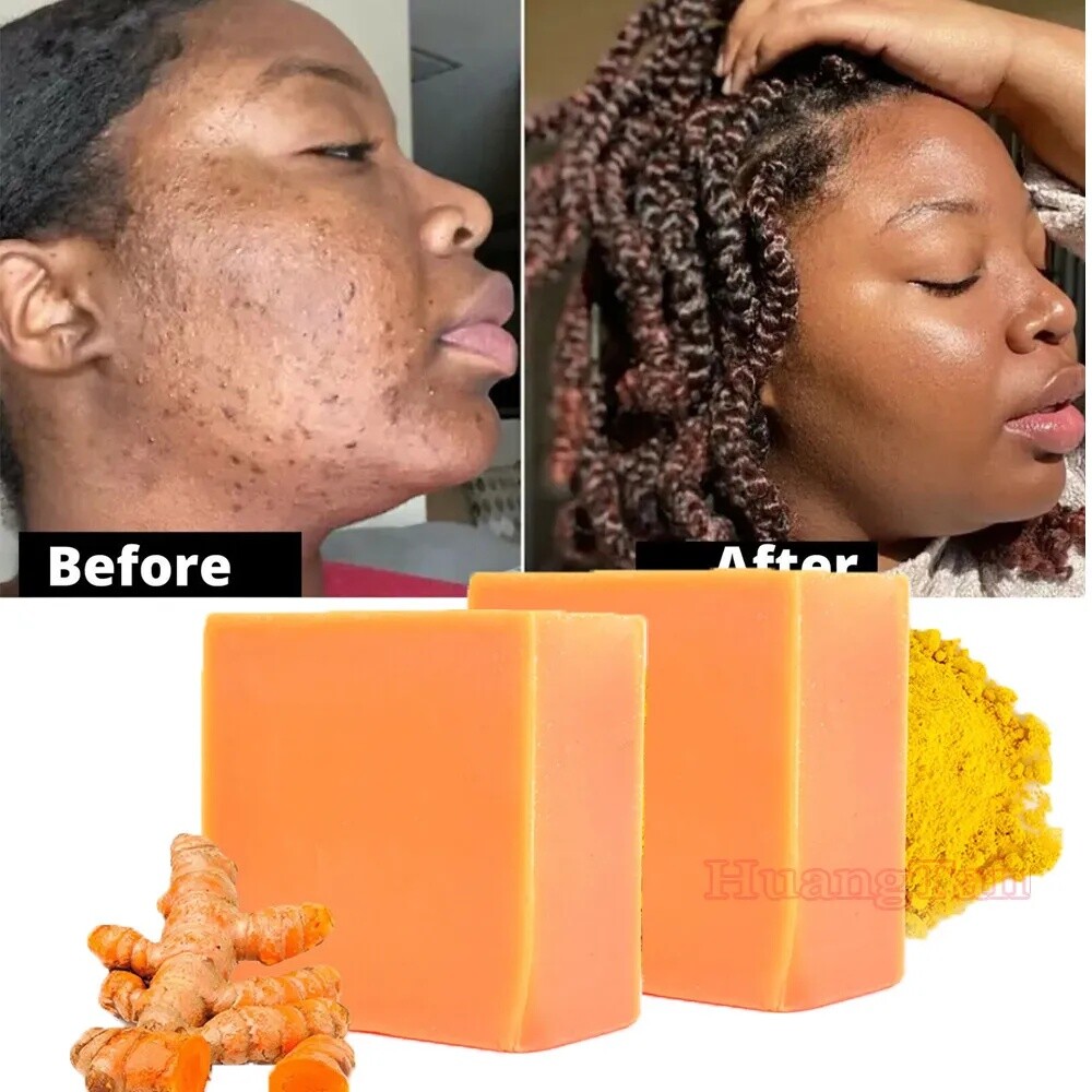 2× Tumeric Soap Skin Whitening Dark Spots lightening Acne Brightening Turmeric
