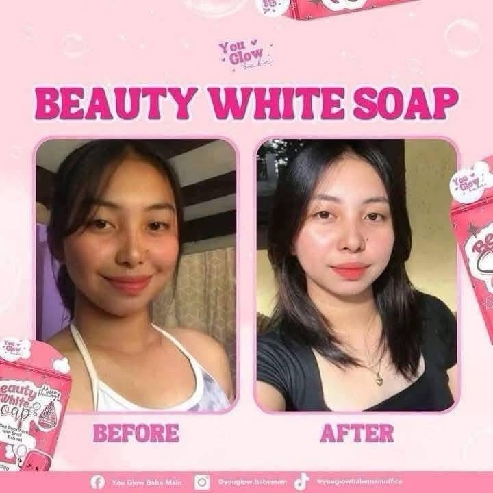 Beauty White Soap by You Glow Babe, 5 Bars x 70g