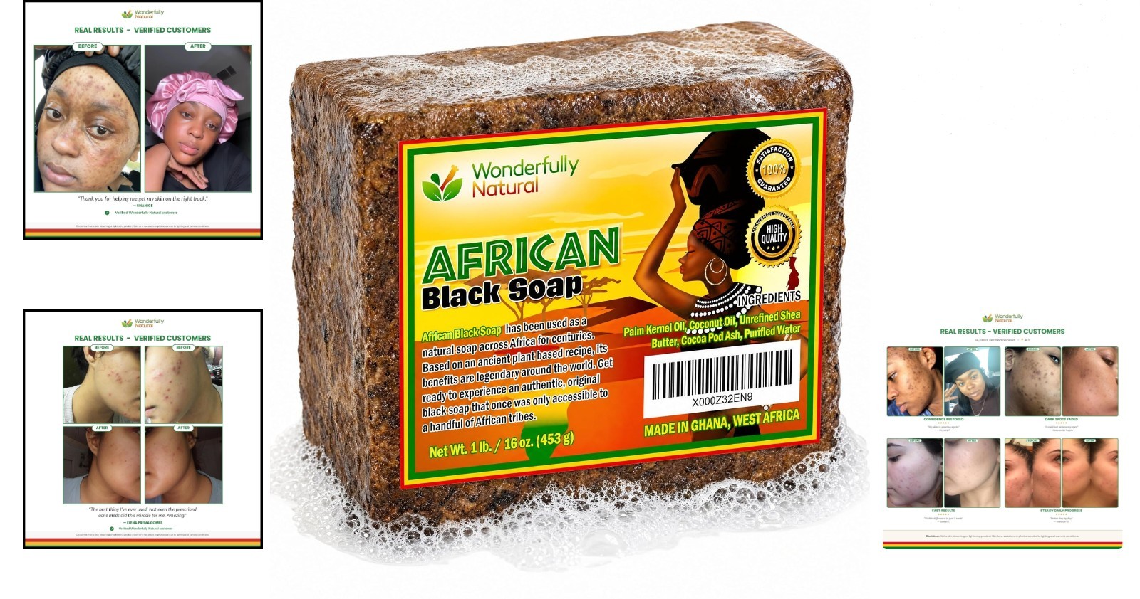 Unscented African Black Soap for Sensitive Skin – Acne & Dark Spot Solution