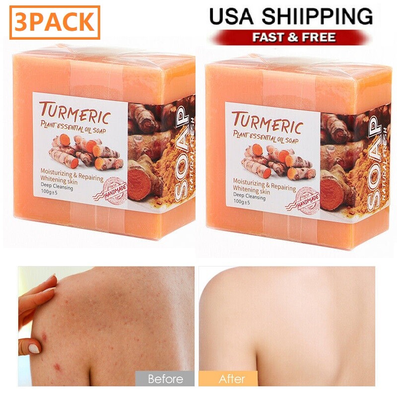 3PCS Tumeric Soap Skin Whitening Dark Spots lightening Acne Brightening Turmeric
