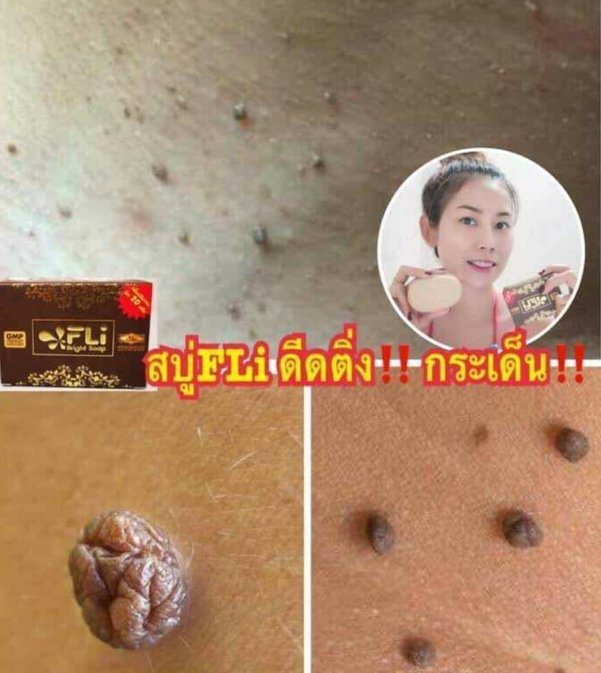 6x FLI Bright Soap Whitening Skin Legendary 9 Thai Herbal Face Body Health
