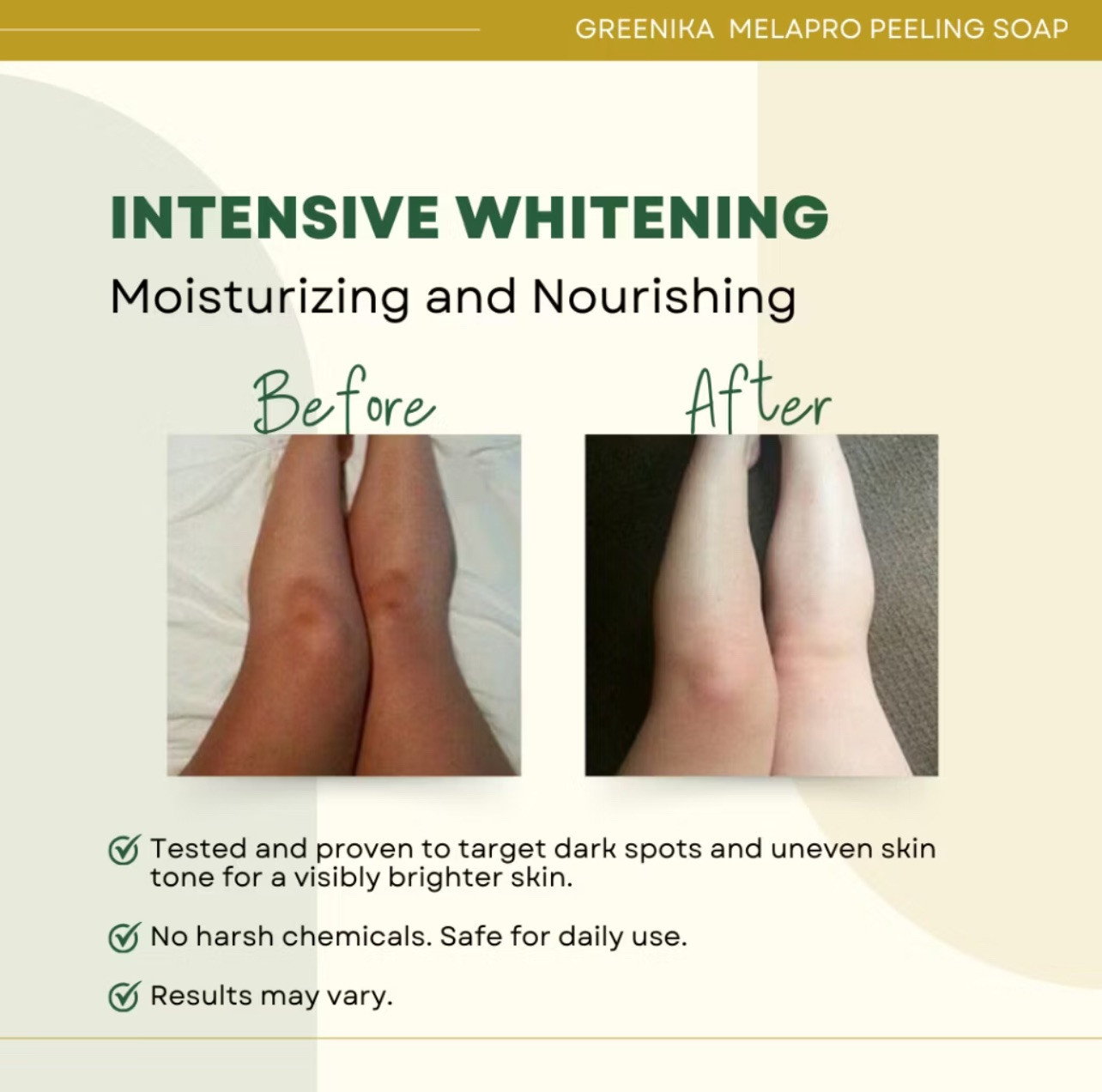 Greenika MELASMA PEELING SOAP for Melasma, Dark Spots & Sun Damaged Skin (135g)