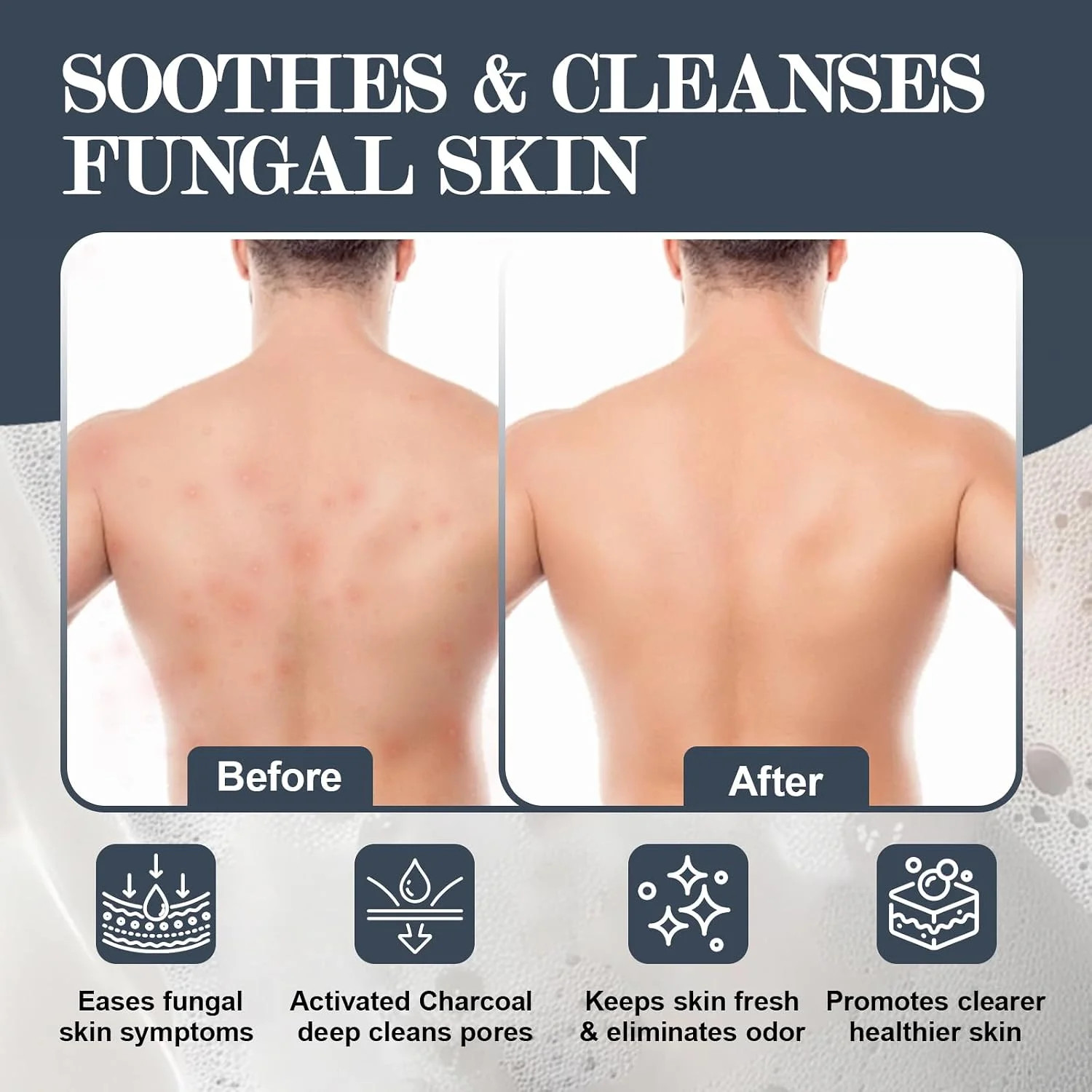 3 Pcs Veloma Antifungal Soap,Veloma Soap,Soothing Tea Tree & Eucalyptus, Deep Po