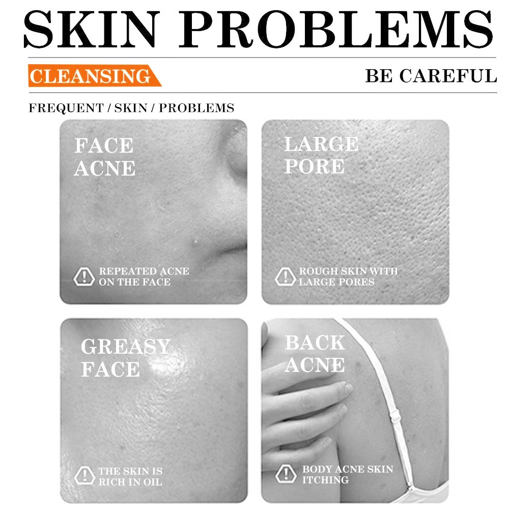 Kojic Acid Soap Dark Spot Whitening Turmeric Soap Skin Bleaching Lightening 100G