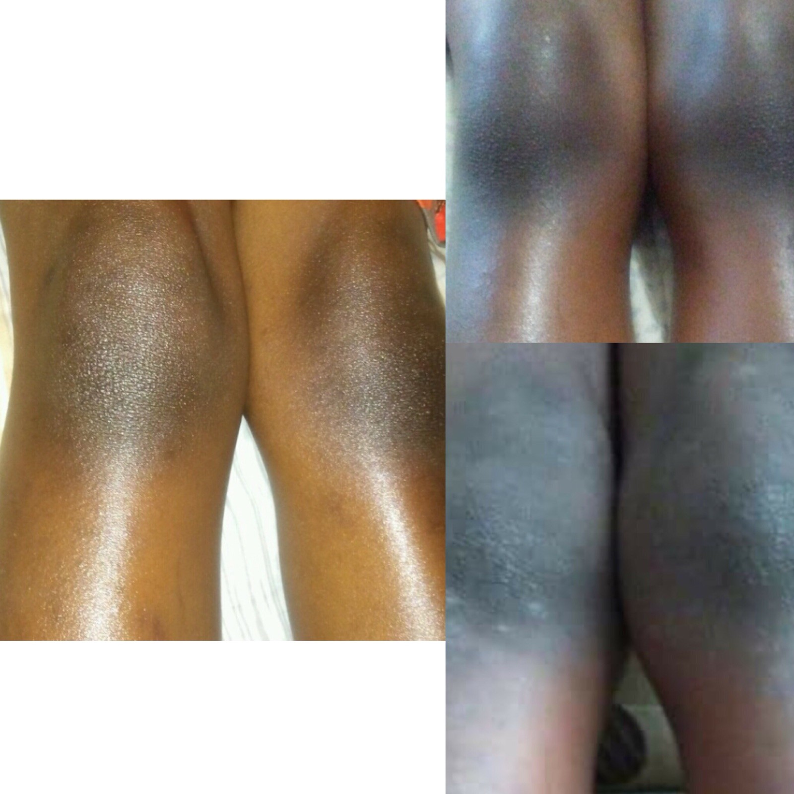 First Step Black Soap Body Wash for Eczema and Sensitive Dry & Oily Skin