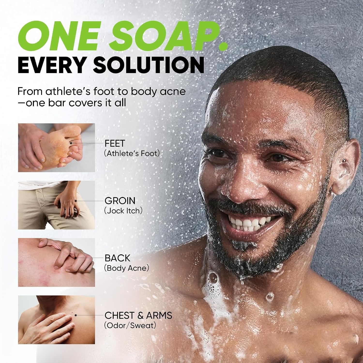 Antifungal Soap for Active Skin – Medicated Bar for Athlete’s Foot, Jock Itch…