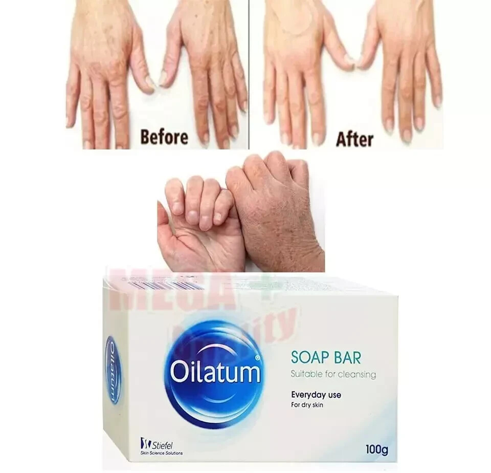 Oilatum Soap Bar Stiefel for Dry Skin Gently Cleanses Moisturises Protects X 3