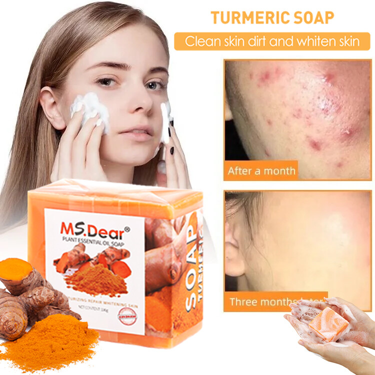 3PCS Tumeric Soap For Dark Spots, Skin Lightening, Anti Acne Skin Cleansing Soap