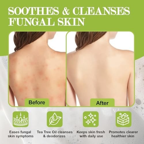 3 Pcs Veloma Antifungal Soap,Veloma Soap,Soothing Tea Tree & Eucalyptus, Deep Po