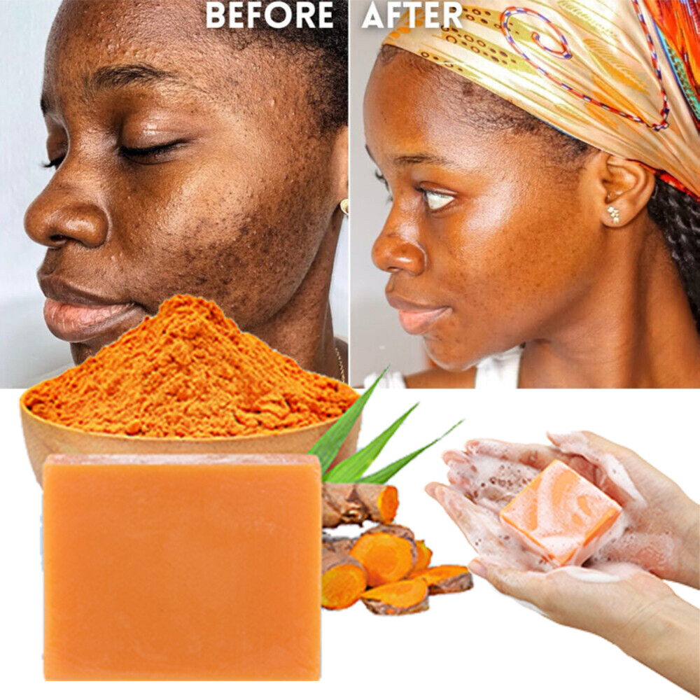 3-1X Tumeric Soap Skin Whitening Dark Spots lightening Acne Brightening Turmeric