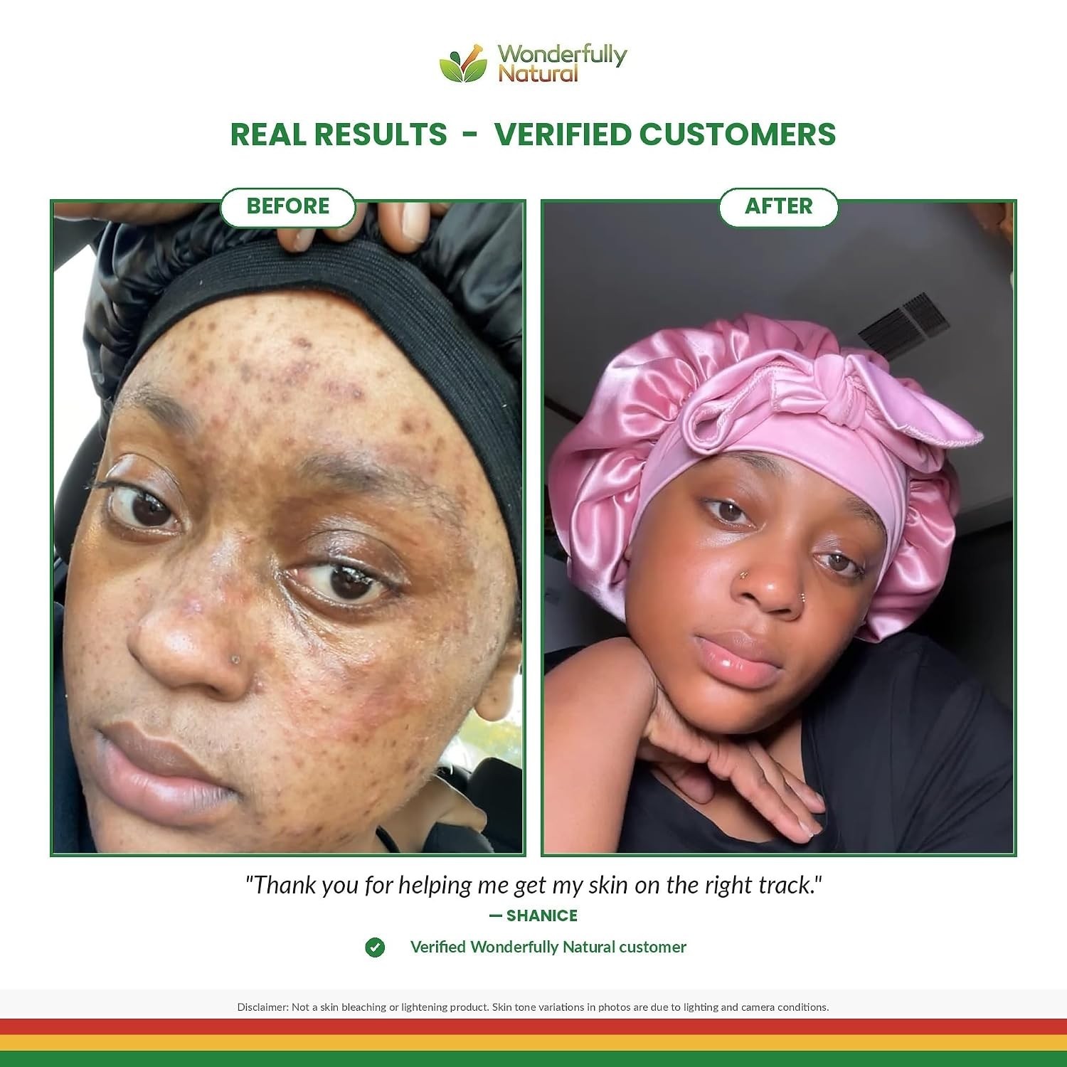 Unscented Organic African Black Soap – Fights Acne & Brightens Skin Tone