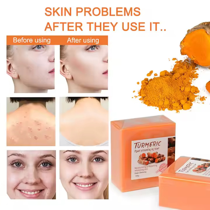 2PCS handmade tumeric bar soap bath anti acne dark spots removal and whitening.