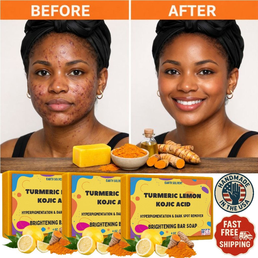 Kojic Acid Soap Dark Spot Whitening Turmeric Skin Bleaching Lightening 4oz – 3PK