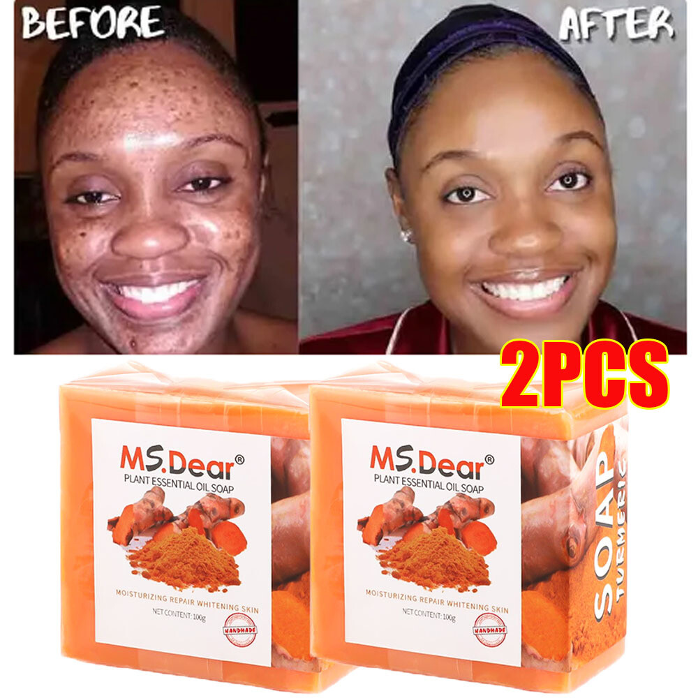 2x Tumeric Soap Acne Dark Spot Removal Skin Whitening Facial Body Bleaching Soap