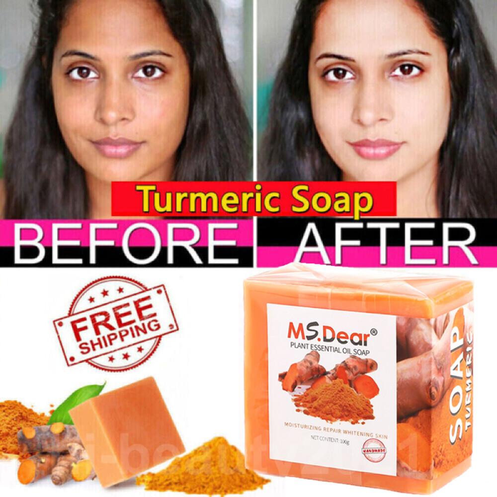 Tumeric Soap Acne Dark Spots Removal Skin Whitening Facial & Body Bleaching Soap