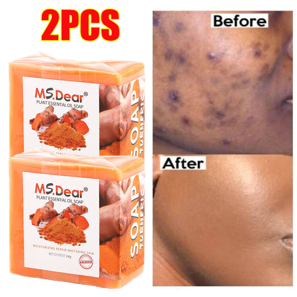 2x Tumeric Soap Acne Dark Spot Removal Skin Whitening Facial Body Bleaching Soap