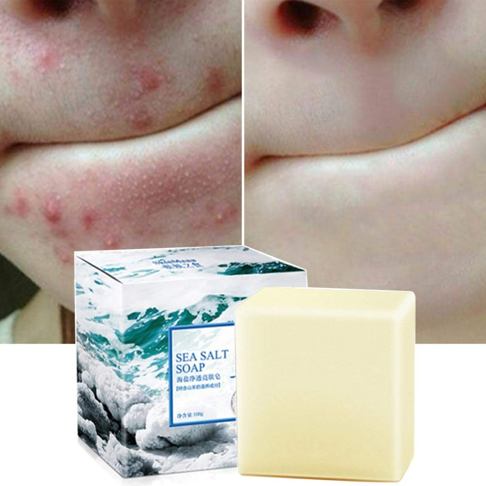 Unscented Organic Sea Salt Soap with Goat’s Milk – Acne Treatment 3.52 Oz