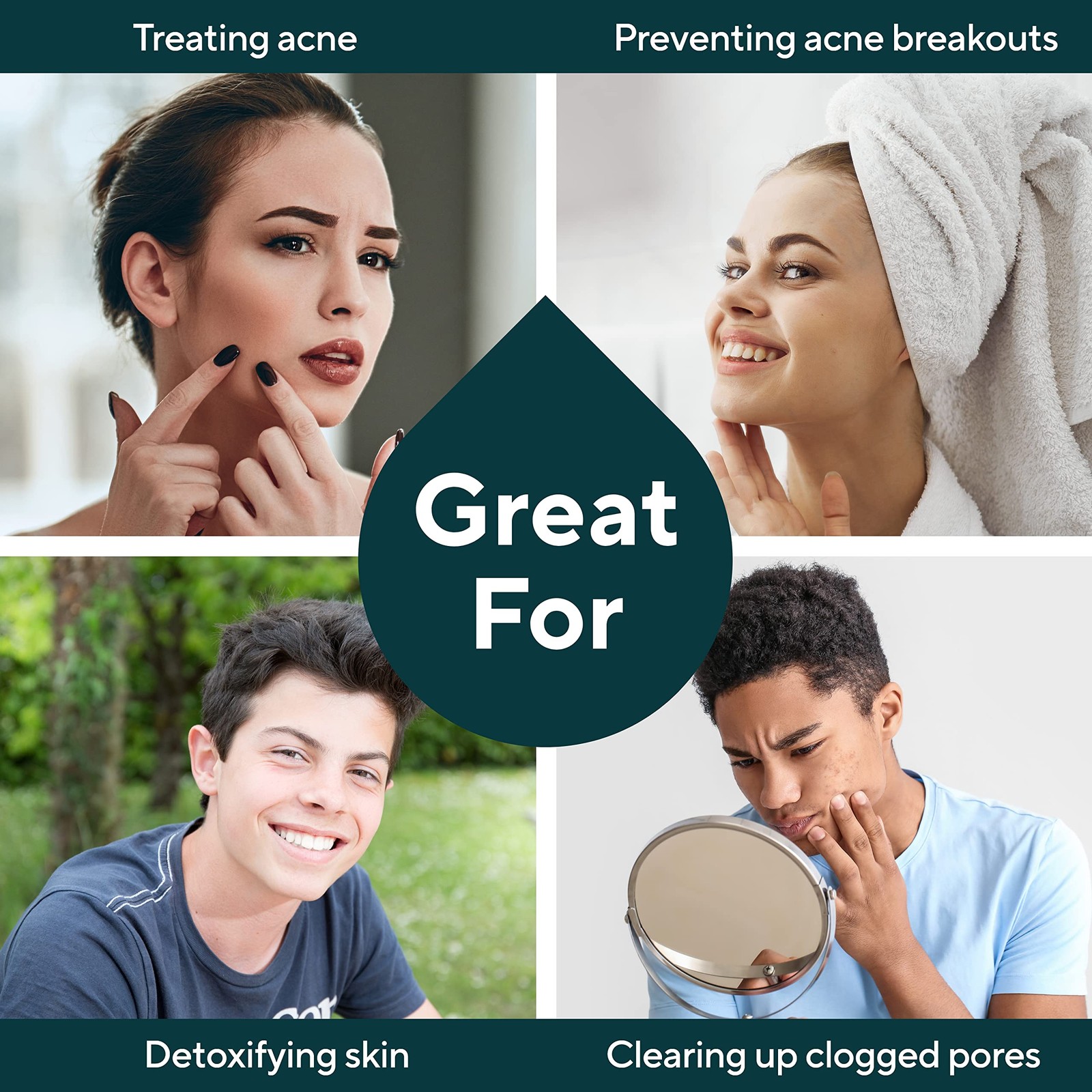 Marie’s Original Acne Bar Soap Cleanser for Face and Body | Acne Treatment wi…