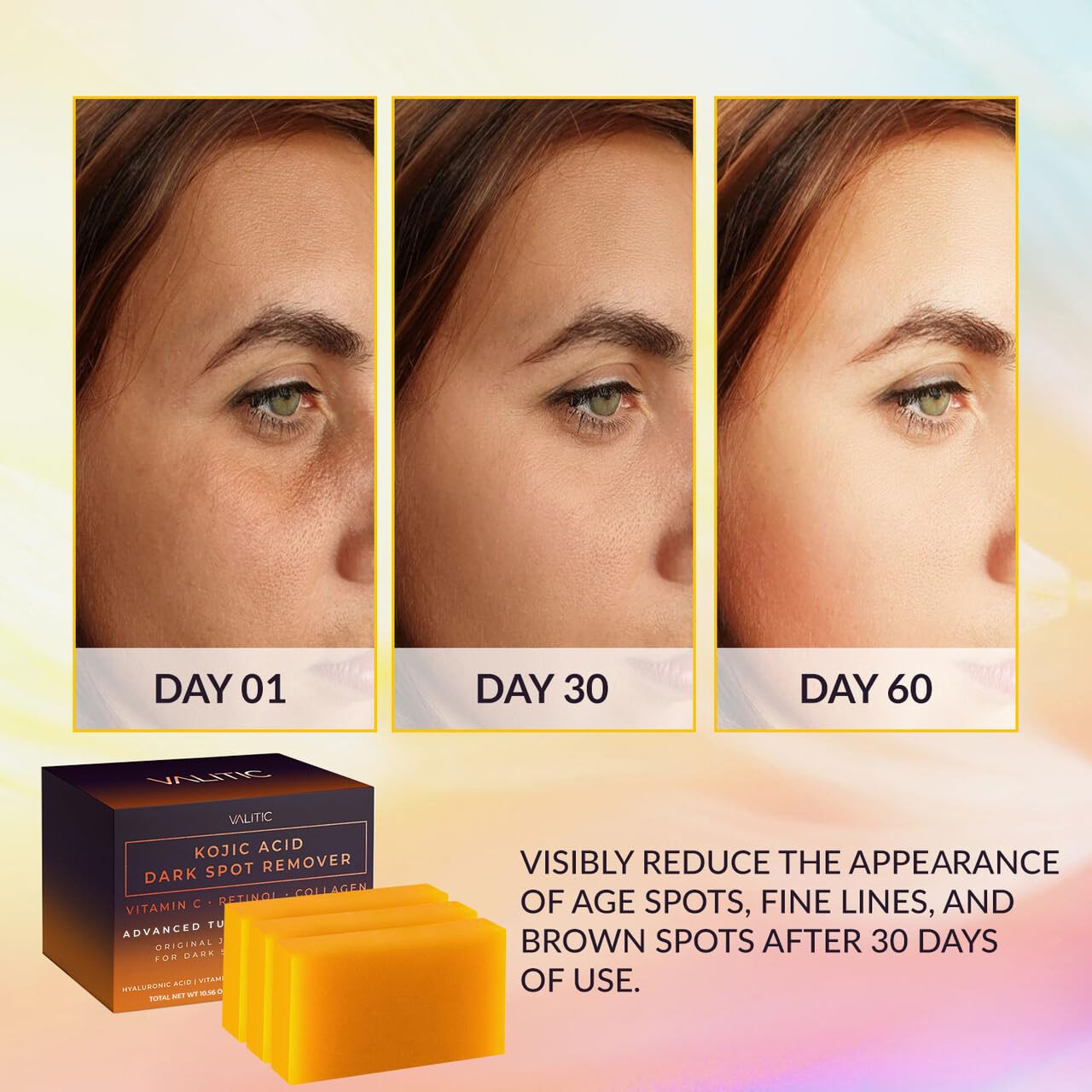 Kojic Acid Dark Spot Remover Soap Bars with Vitamin C & Retinol (3 Pack)